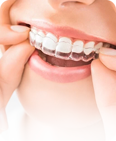 Braces & Aligners