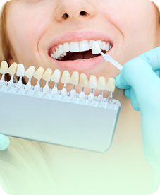 Tooth Whitening