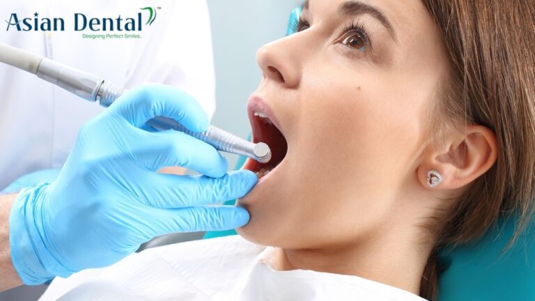 Root Canal Treatment: What you need to know about