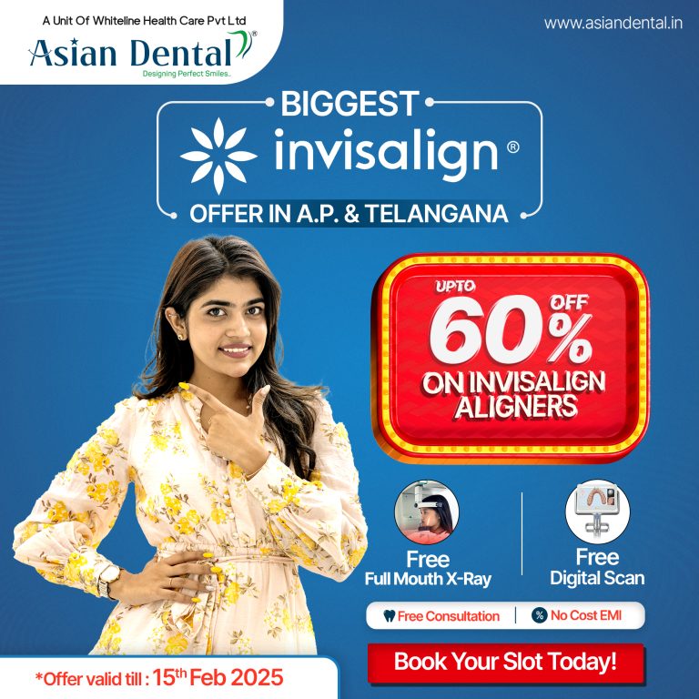 Price of Invisalign Aligners in Vijayawada