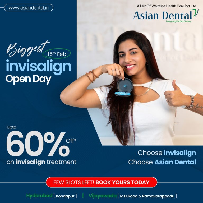 Best Invisalign Treatment in Vijayawada