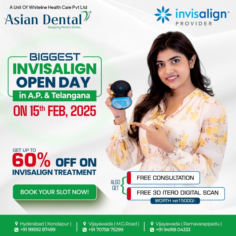 Invisalign Clear Aligners in Vijayawada