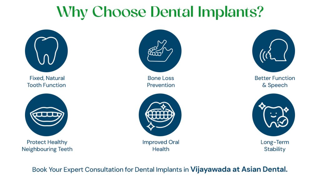 choose dental implant