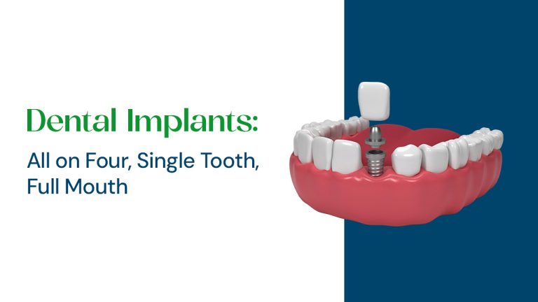 dental implant types