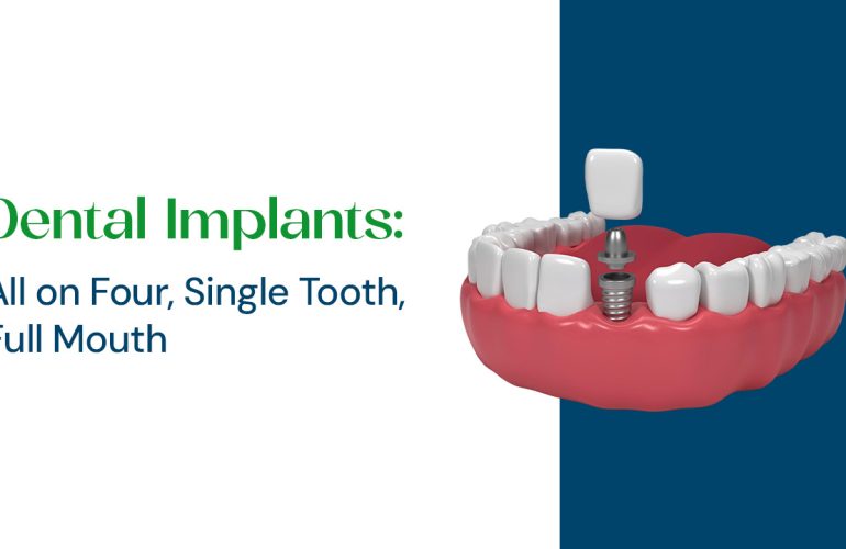 dental implant types