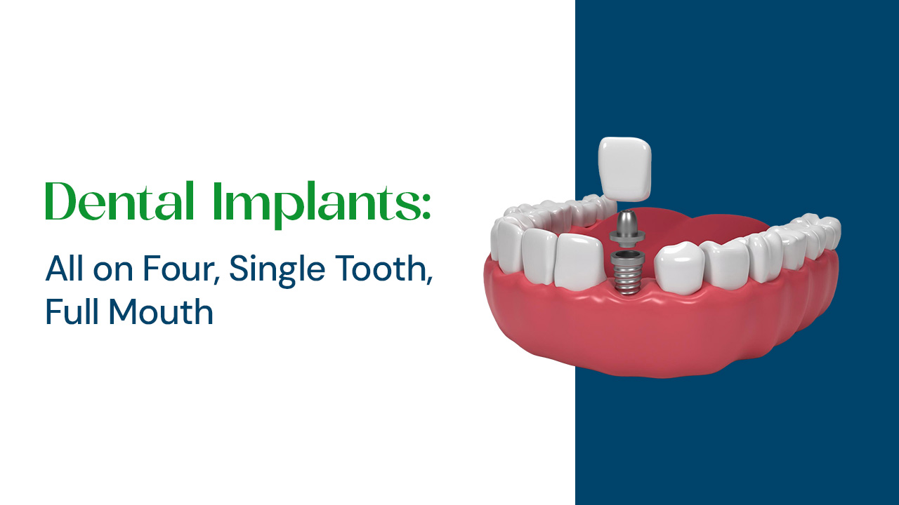 dental implant types