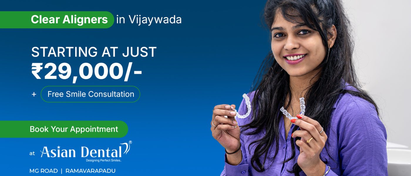 Aligners-Vijaywada
