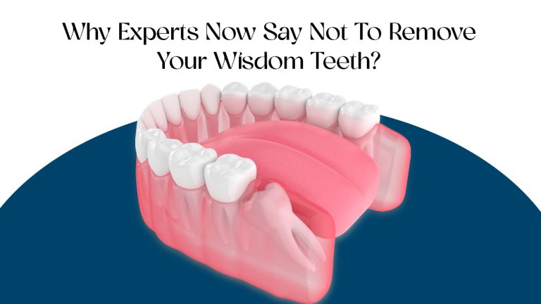 why experts now say not to remove your wisdom teeth?