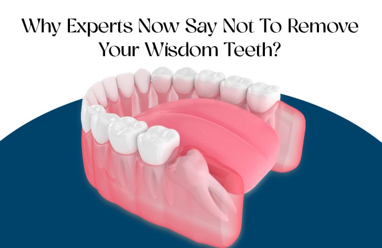 why experts now say not to remove your wisdom teeth?