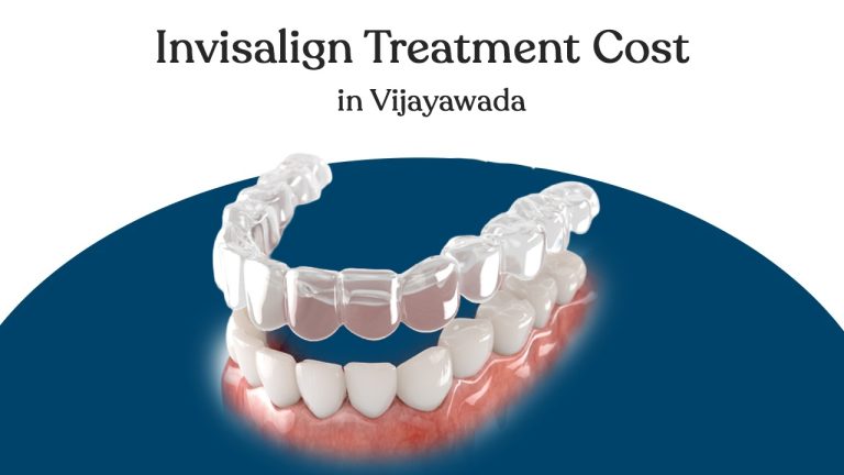 invisalign treatment cost in vijayawada
