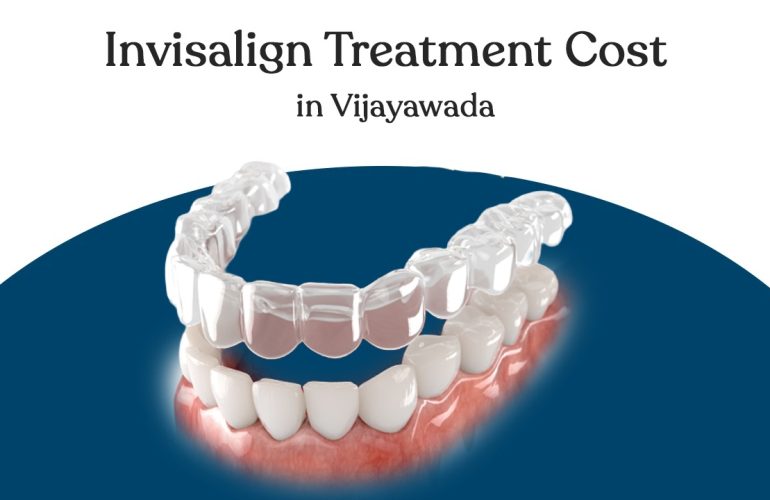 invisalign treatment cost in vijayawada