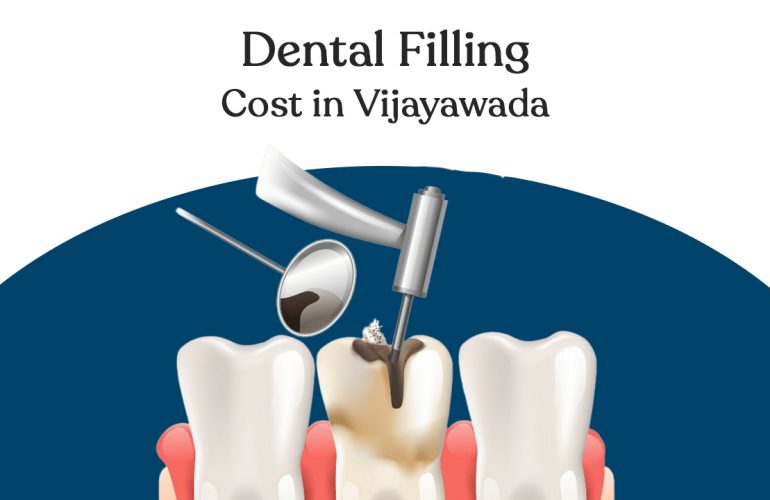 dental filling cost in vijayawada